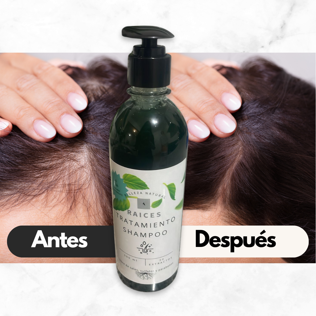 Shampoo Akana Tratamiento